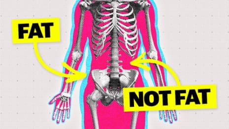 I've lost my butt': how rapid weight loss can leave you with less muscle and more fat | Health & wellbeing | The Guardian I've lost my butt': how rapid weight loss can leave you with less muscle and more fat | Health & wellbeing | The Guardian