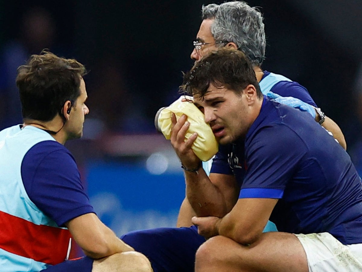Wounded but not sunk': Dupont undergoes surgery on facial injury | France rugby union team | The Guardian