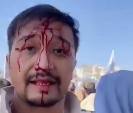 A still from a video of an Australian man after being beaten at a Taliban checkpoint on the way to Kabul airport.