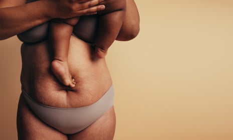 Post-pregnancy body positivity? On Instagram, it's hard to find