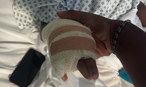 Raheem Bailey showing hand with amputated finger