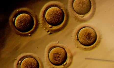 Human embryos on a petri dish are viewed through a microscope.