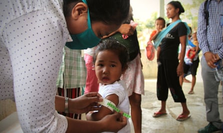 In Covalima, nurses use a colour-coded tag to measure children’s middle upper arm circumference and see if it is thick enough for their age.