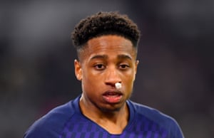 Walker-Peters after receiving medical treatment for a hit in the face.