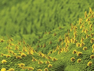 Cannabis resin is produced by the glandular hairs (trichomes, here yellow) on the leaves of the plant Cannabis sativa, the green cells in this image. Those using the plant recreationally will know that hash comes from this resin, while marijuana is made from the leaves and flowers.