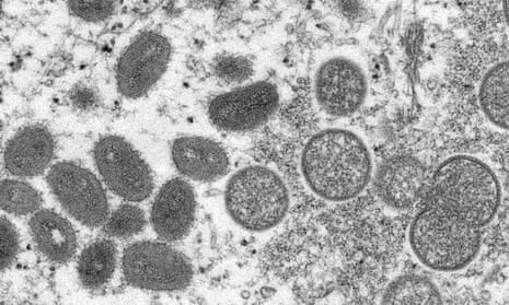 Electron microscope image showing mature, oval-shaped monkeypox virions and spherical immature virions from 2003 US outbreak