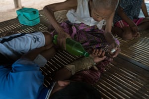 Tevy, 73, applies a mix of rice wine and roots to her grandson’s broken arm