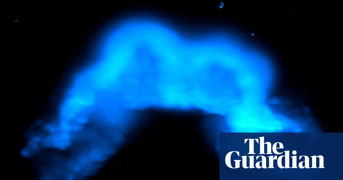 Moment of heart’s formation captured in images for first time