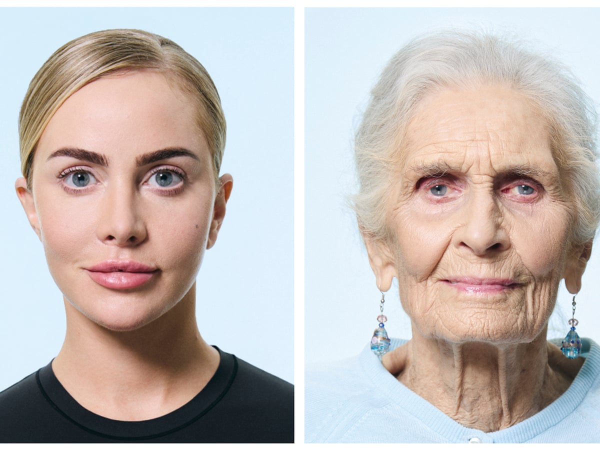 Be honest, have you had work? 11 people open up about what they do or don't do to their face | Beauty | The Guardian Be honest, have you had work? 11 people open up about what they do or don't do to their face | Beauty | The Guardian