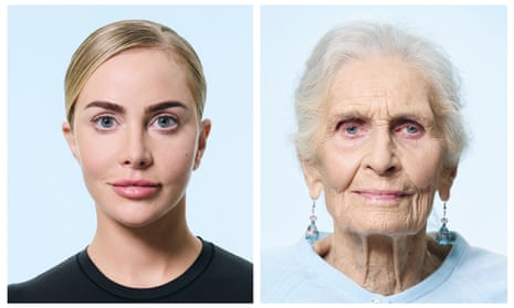 Be honest, have you had work? 11 people open up about what they do or don't do to their face | Beauty | The Guardian Be honest, have you had work? 11 people open up about what they do or don't do to their face | Beauty | The Guardian
