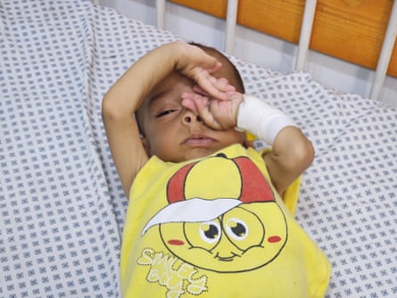 Mohammed Aliwa is in hospital with severe malnutrition.