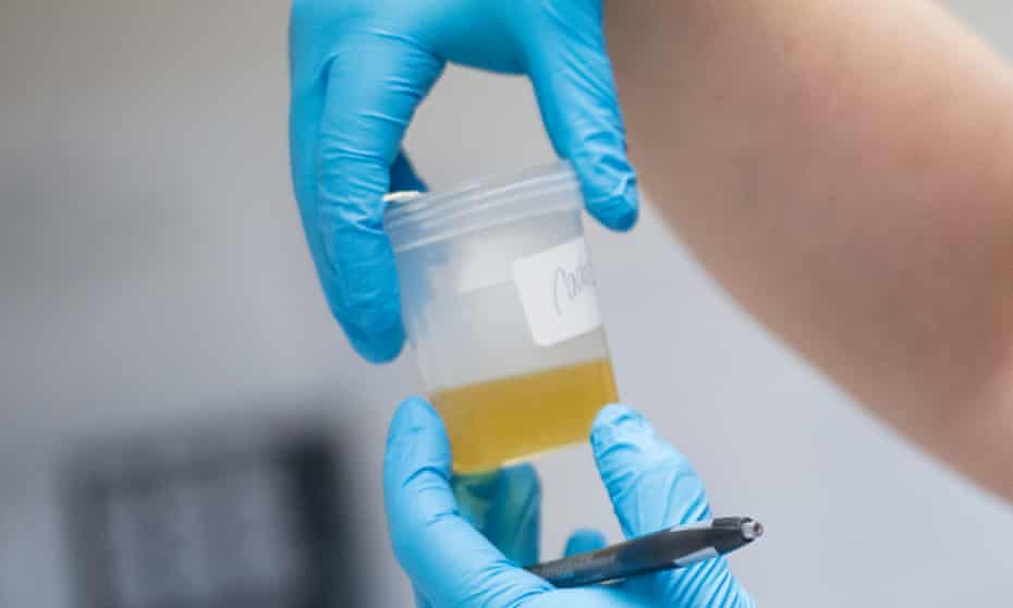 subscribe here, top health wellness news without politics, Antibiotics Used To Treat UTIs May Be Cause of Recurrent Infection