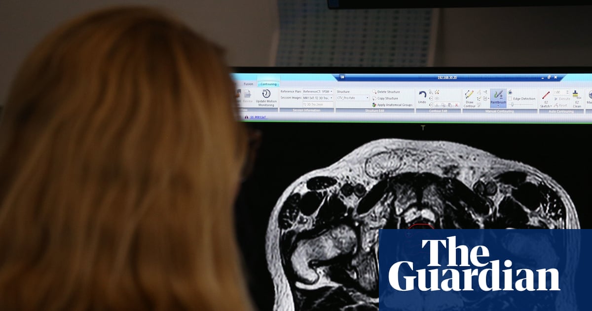 More than 60,000 cancer patients in England ‘not getting necessary radiotherapy’