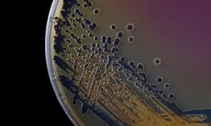 Black bacterial colonies of salmonella. Food poisoning outbreaks are much higher than in the UK.