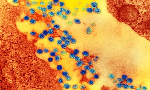 A transmission electron micrograph of Rubella virus particles.
