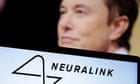 Elon Musk’s Neuralink shows brain-chip patient playing online chess