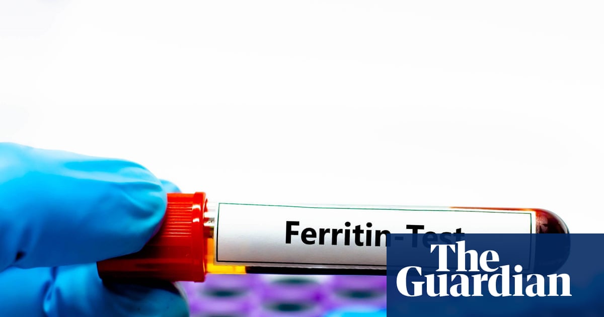 ‘Ferritin face’: are social media claims about iron deficiency fact – or fiction?