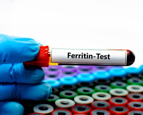 By measuring ferritin levels via a blood test it is possible to get a snapshot of the body’s iron reserves