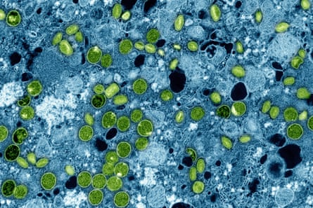 An electron microscope image showing green mpox virus particles within infected blue cultured cells.