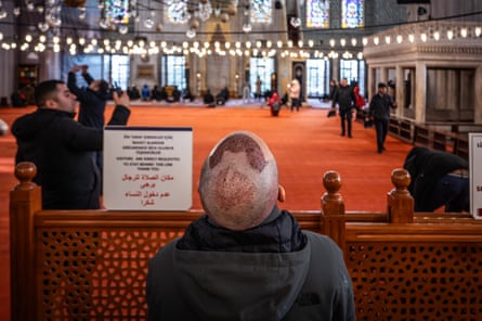 A man who has just undergone a hair transplant visiting the Sultan Ahmet Camii
