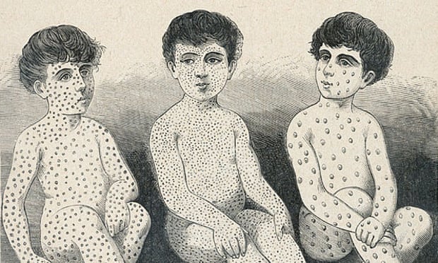Scarlet fever outbreak fears: What are the symptoms, what treatment is available and how is it spread?, The Independent