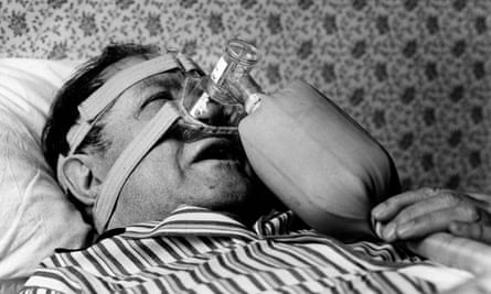 Patient Michael English trying out some then revolutionary snoring equipment in 1986.