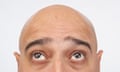 Close up of a bald man looking up