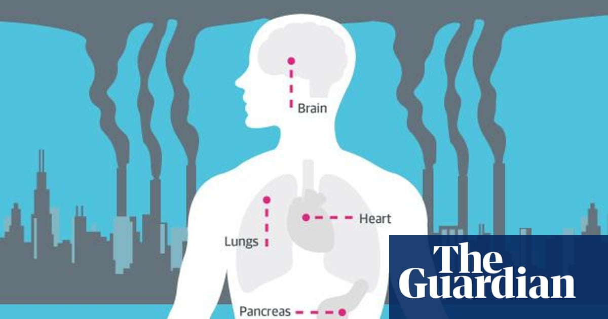 How Air Pollution Affects Your Health Infographic Guardian Sustainable Business The Guardian