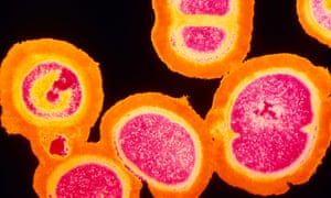 MRSA resistant Staphylococcus bacteria<br>MRSA: resistant Staphylococcus bacteria. Coloured transmission electron micrograph (TEM) of a deadly cluster of MRSA Staphylococcus aureus bacteria. Strains of MRSA (Methicillin-resistant Staphylo- coccus aureus) bacteria are resistant to most antibiotic drug agents; some yield to vancomycin. It is a Gram-positive spherical (coccus) bacteria. Here, some bacteria are seen dividing. MRSA is common in hospitals, infecting wounds of patients. S.aureus may cause boils, usually by entering the skin through a hair follicle or a cut. They are also responsible for internal abscesses and most types of acute suppurative infection. Magnification: x24, 000 at 6x4.5cm size.