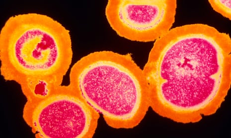 A deadly cluster of MRSA staphylococcus aureus bacteria.