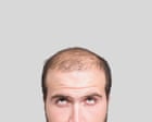 20 fascinating facts about hair: why baldness is super-masculine – and a pubic bush could be a ‘cheating detector’