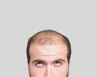 Close up of bald young man