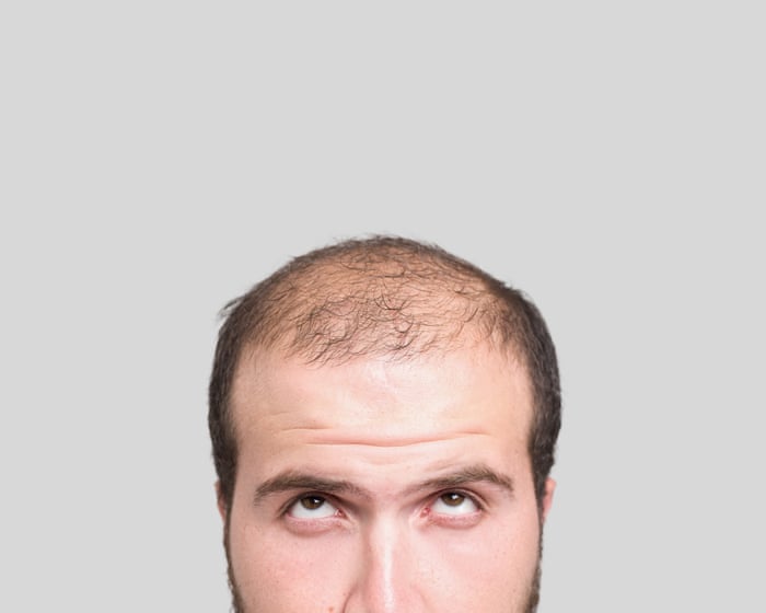 20 fascinating facts about hair: why baldness is super-masculine – and a pubic bush could be a ‘cheating detector’