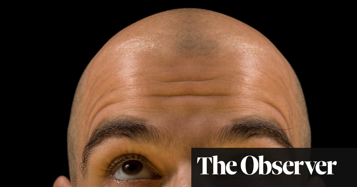 The new growth in hair loss research