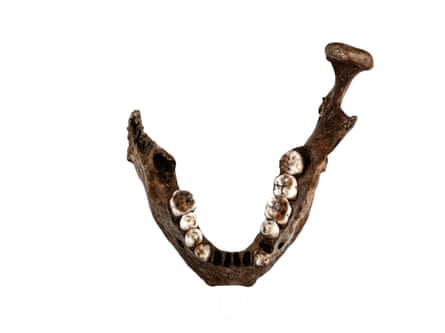 A jawbone against a white backdrop