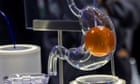 Experts create controllable gastric balloon to aid weight loss