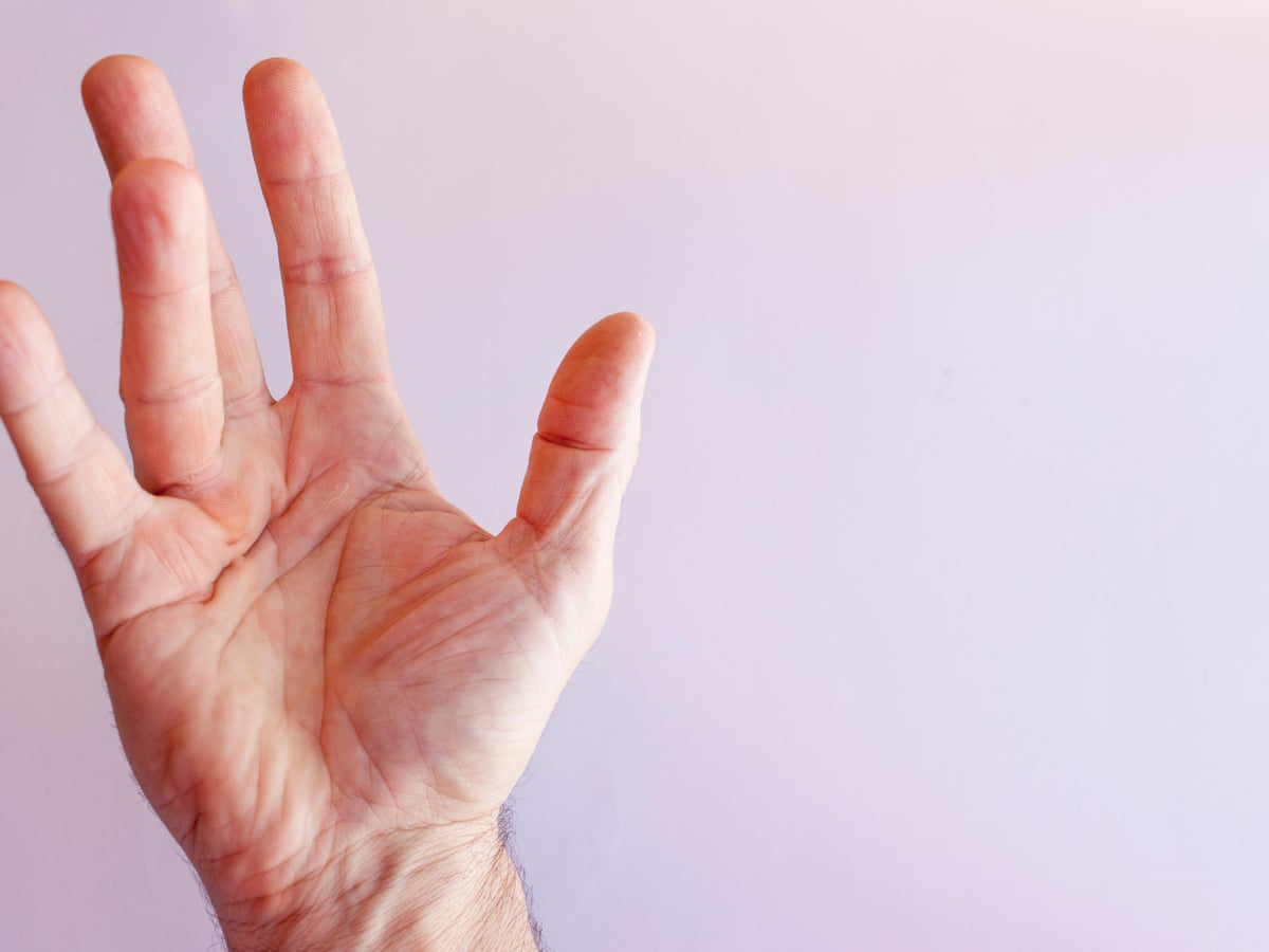 Generic Hand The Impact Of Hand Surgery On Human Identity And Expression | Faculty ...