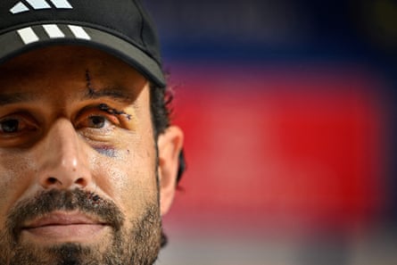 ليون يعود إلى مرسيليا وهو يشعر بالغضب والخوف – لكنه يائس للحصول على النقاط | الدوري الفرنسي 1 ليون يعود إلى مرسيليا وهو يشعر بالغضب والخوف – لكنه يائس للحصول على النقاط | الدوري الفرنسي 1
