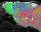 Scientists create mice with part-human brains