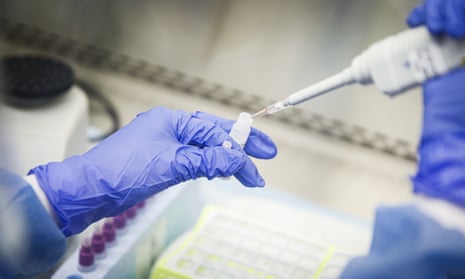A laboratory technician prepares Covid-19 patient samples for semi-automatic testing