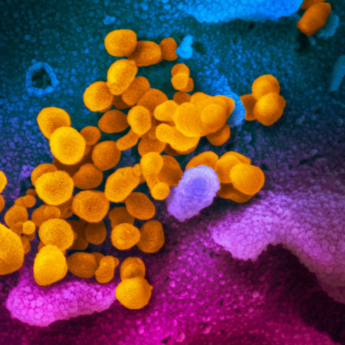 What Is Genomic Sequencing And How Is It Being Used Against Covid 19 In Australia Health The Guardian