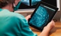 Seated woman clinician examining mammogram on a digital tablet with mammogram x ray on a computer screen in background<br>2BNPYHN Seated woman clinician examining mammogram on a digital tablet with mammogram x ray on a computer screen in background