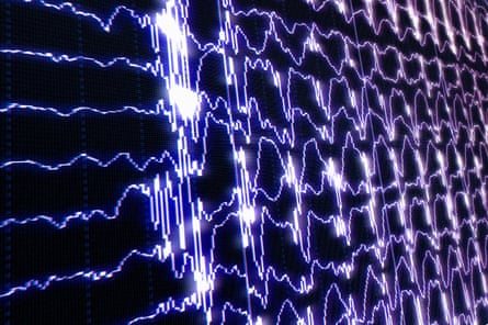 Brain waves during REM sleep and waking up.