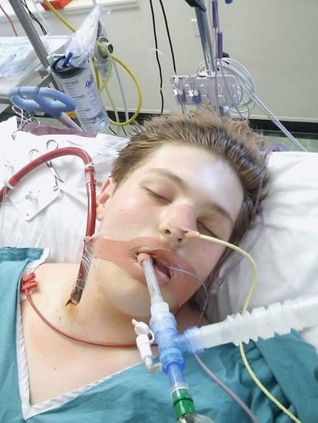 Ewan Fisher, pictured in hospital. He says vaping has ‘ruined’ him