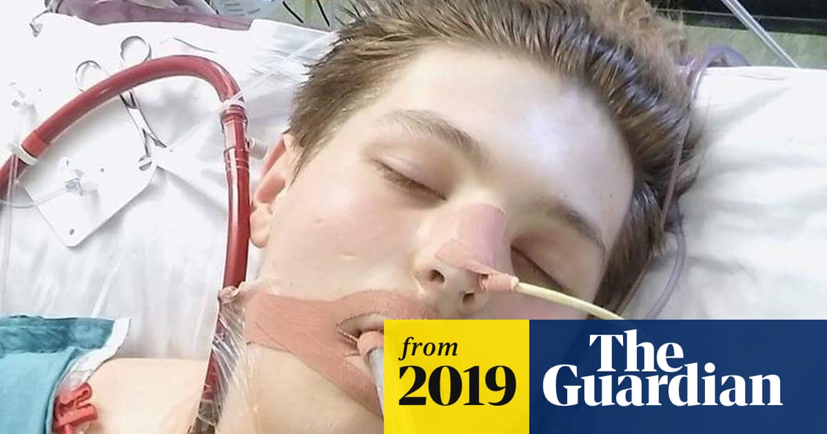 UK teenager needed life support over vaping-linked disease | Vaping | The Guardian UK teenager needed life support over vaping-linked disease | Vaping | The Guardian