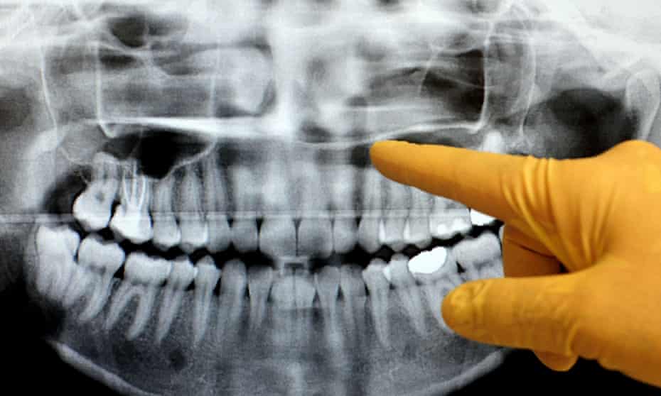 A dentist checks an x-ray of a patient's teeth