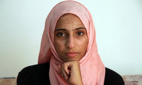Syrian refugee Doaa al -amel, one of the few survivors of a deadly boat journey across the Mediterranean.