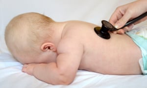 A baby has her heart checked by a doctor with a stethoscope
