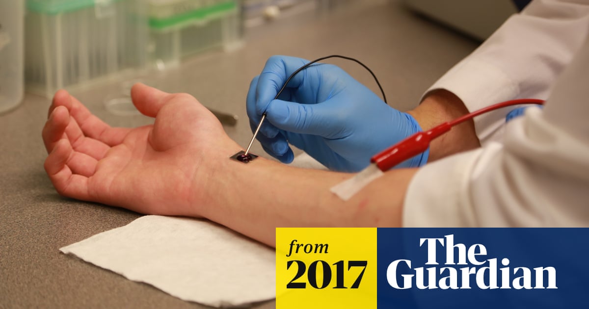 Nanochip could heal injuries or regrow organs with one touch, say researchers