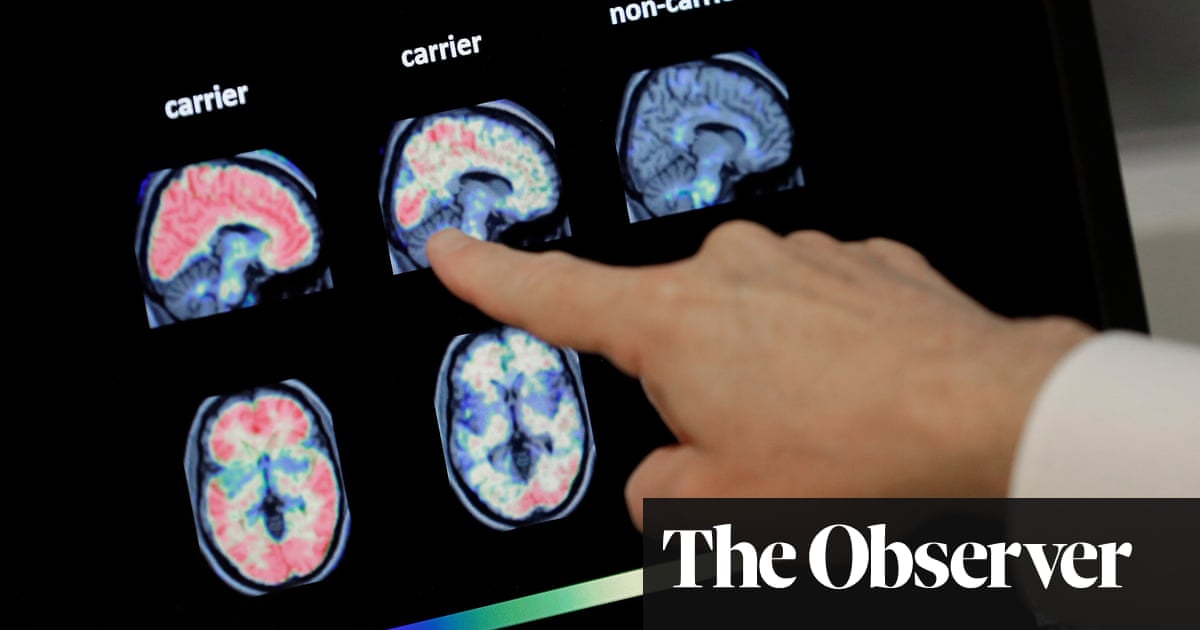 The five: ways to slow the onset of Alzheimer’s - The Guardian thumbnail